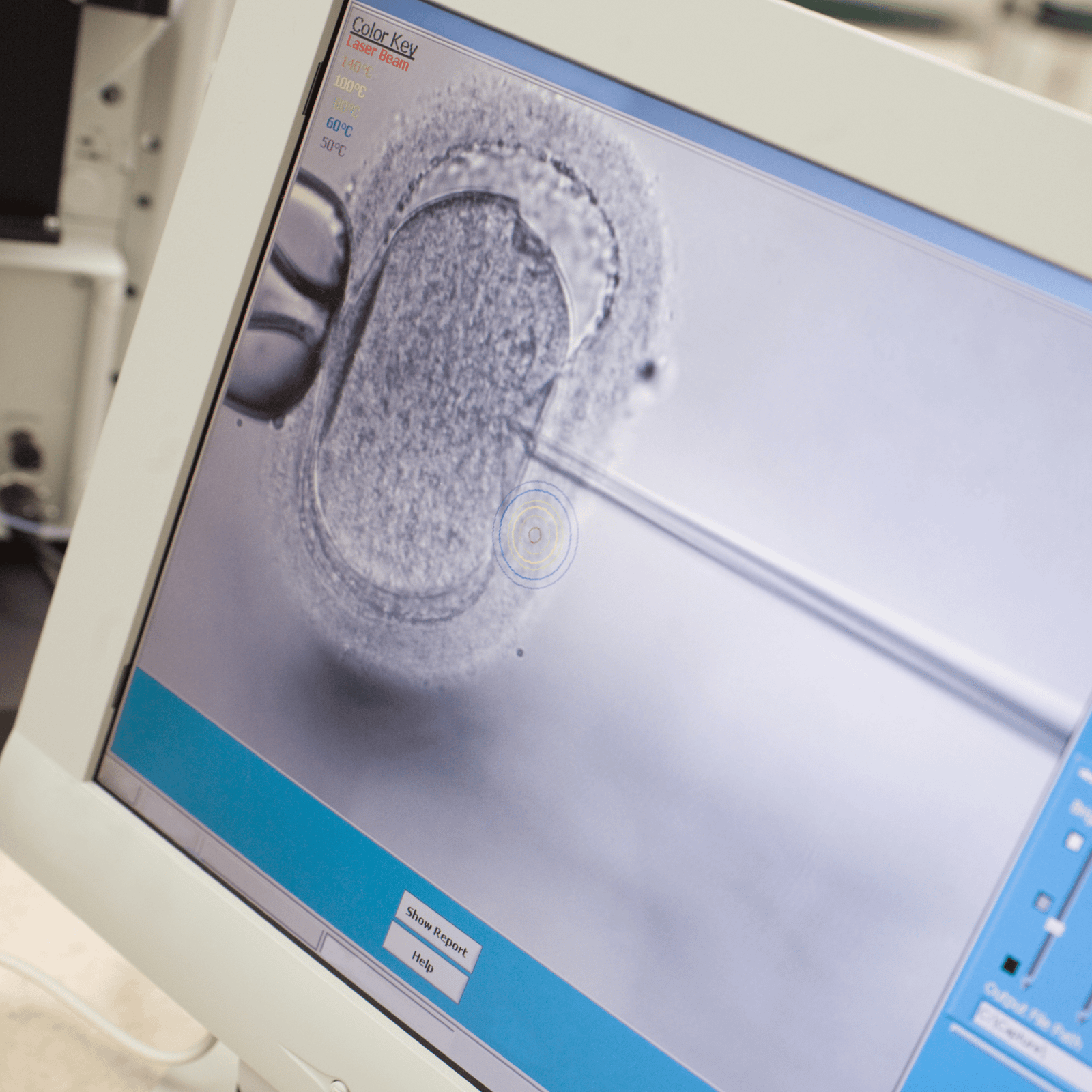 IVF Laboratory